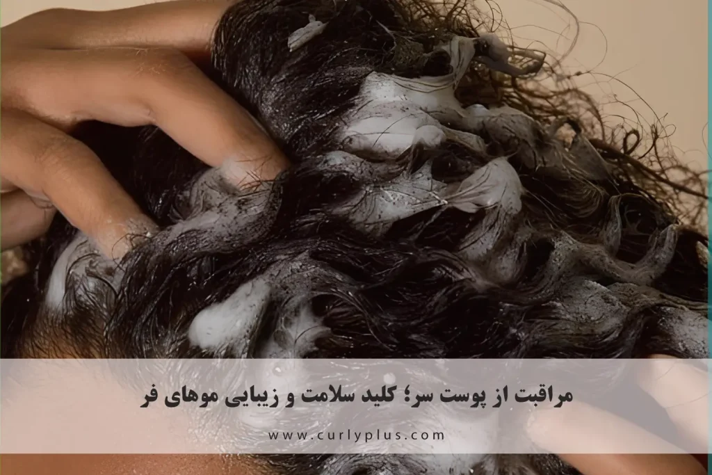مراقبت از پوست سر