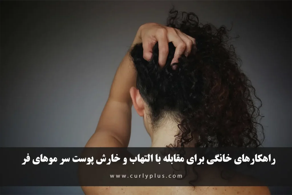 نکاتی برای پیشگیری از خارش و التهاب پوست سر